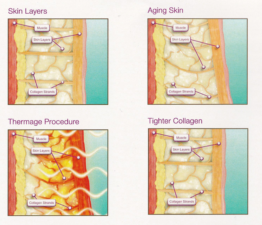 Regain Youthful Look Skin Layers