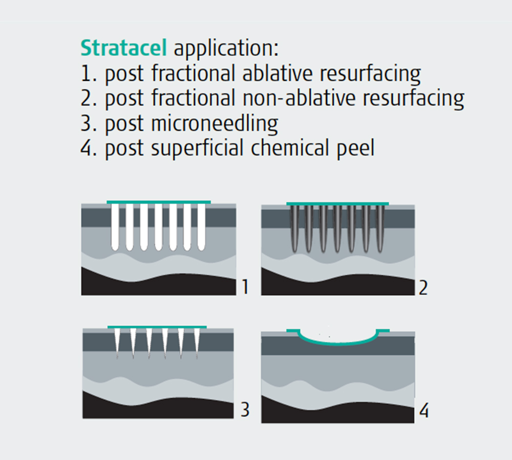 Stratacel-post-operative-skin-care-at-preface-cosmetic-newcastle-nsw