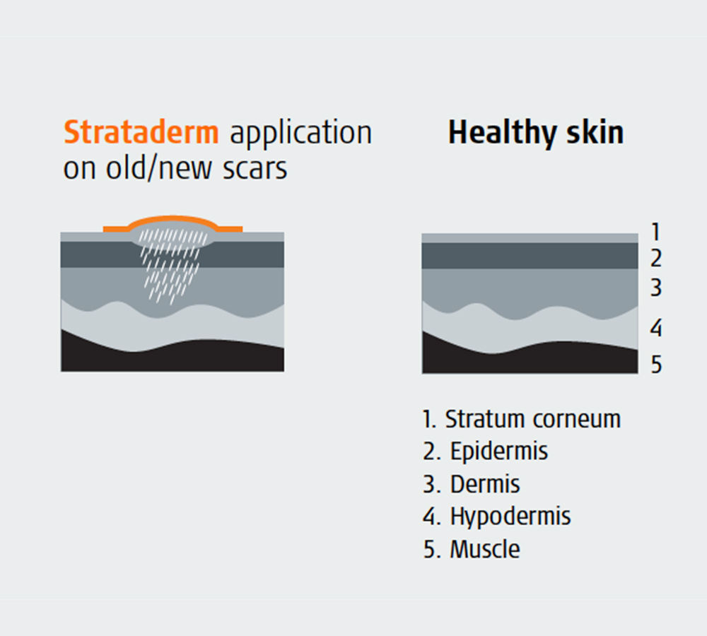 Strataderm-post-operative-skin-care-at-preface-cosmetic-newcastle-nsw