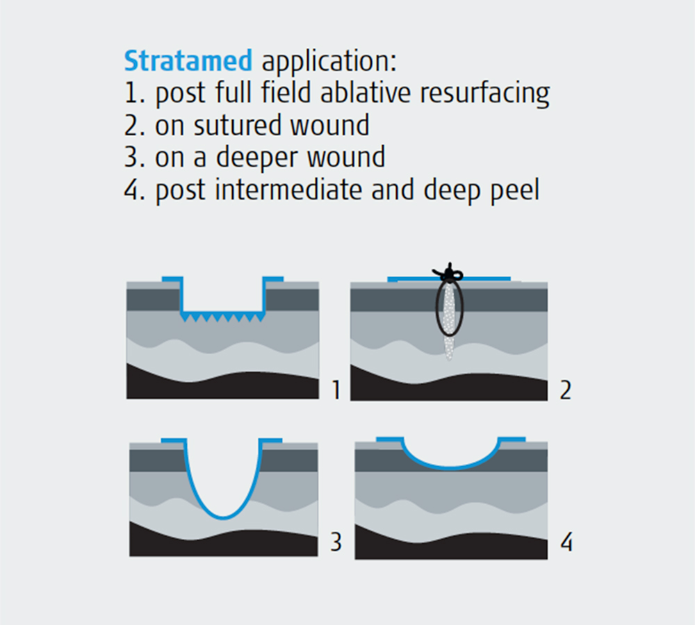 Stratamed-post-operative-skin-care-at-preface-cosmetic-newcastle-nsw