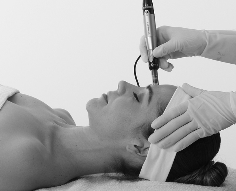 Dermapen Advanced Skin Needling