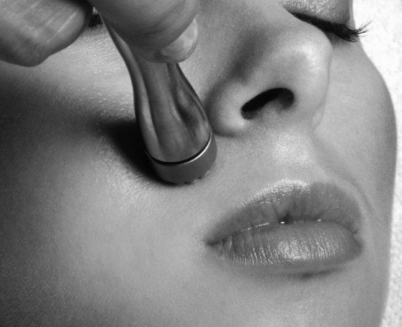 Dermasweep Microdermabrasion