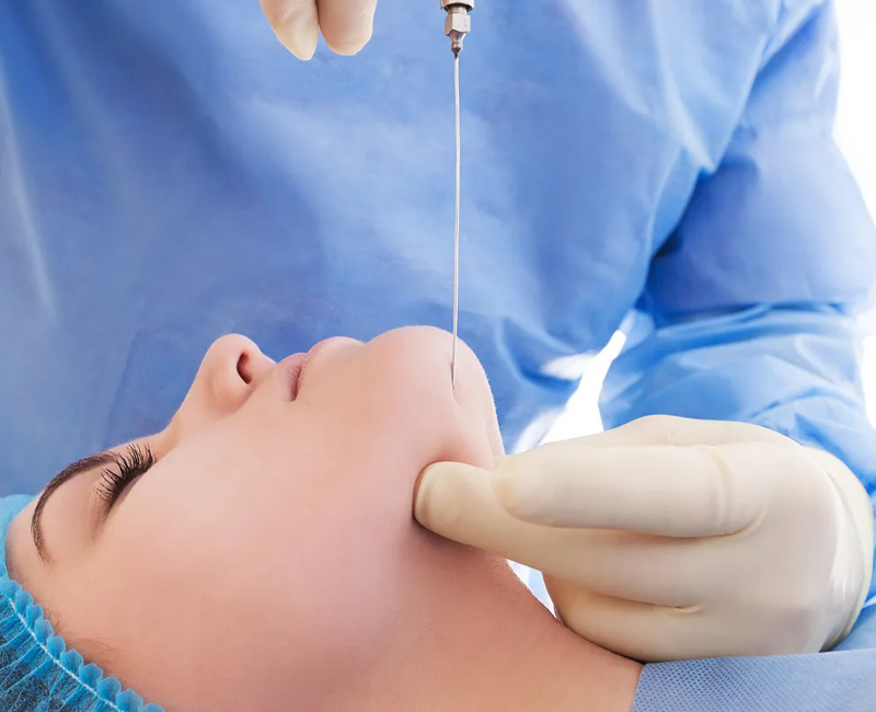 Laser Liposuction Procedure