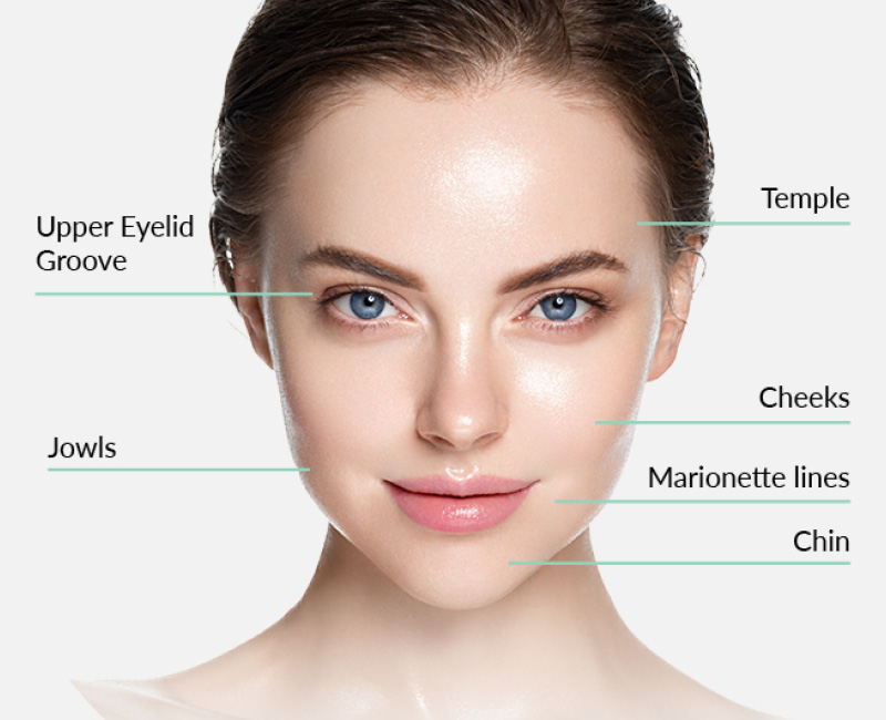 Lipofilling (Fat Transfer) Procedure