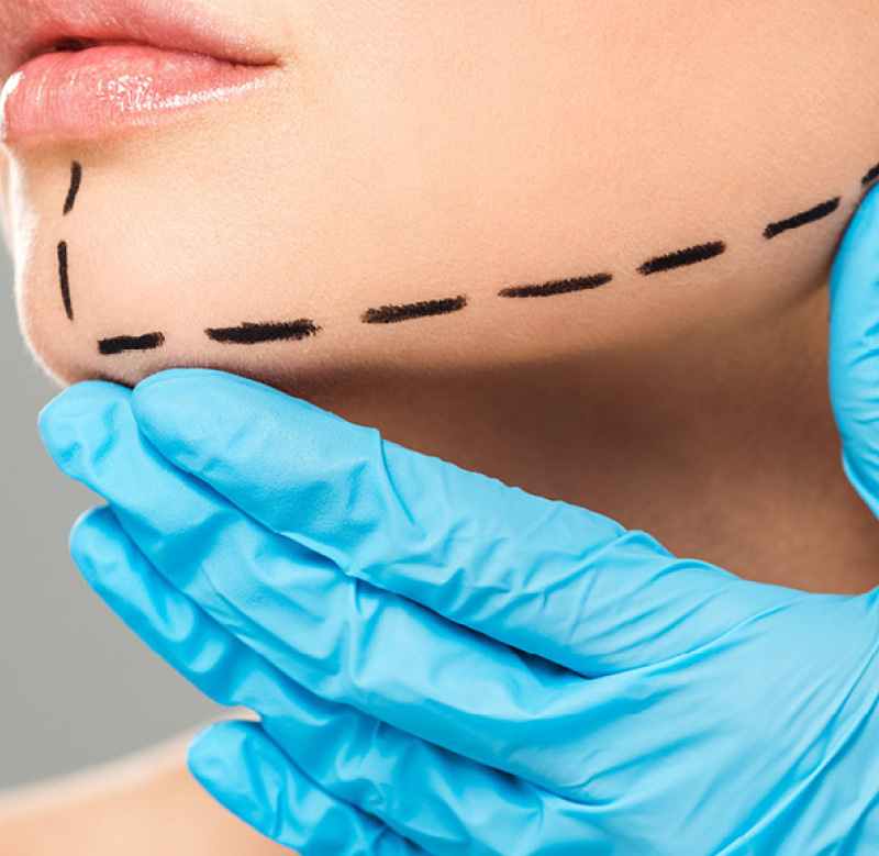 Surgical Procedures at Prèface Cosmetic