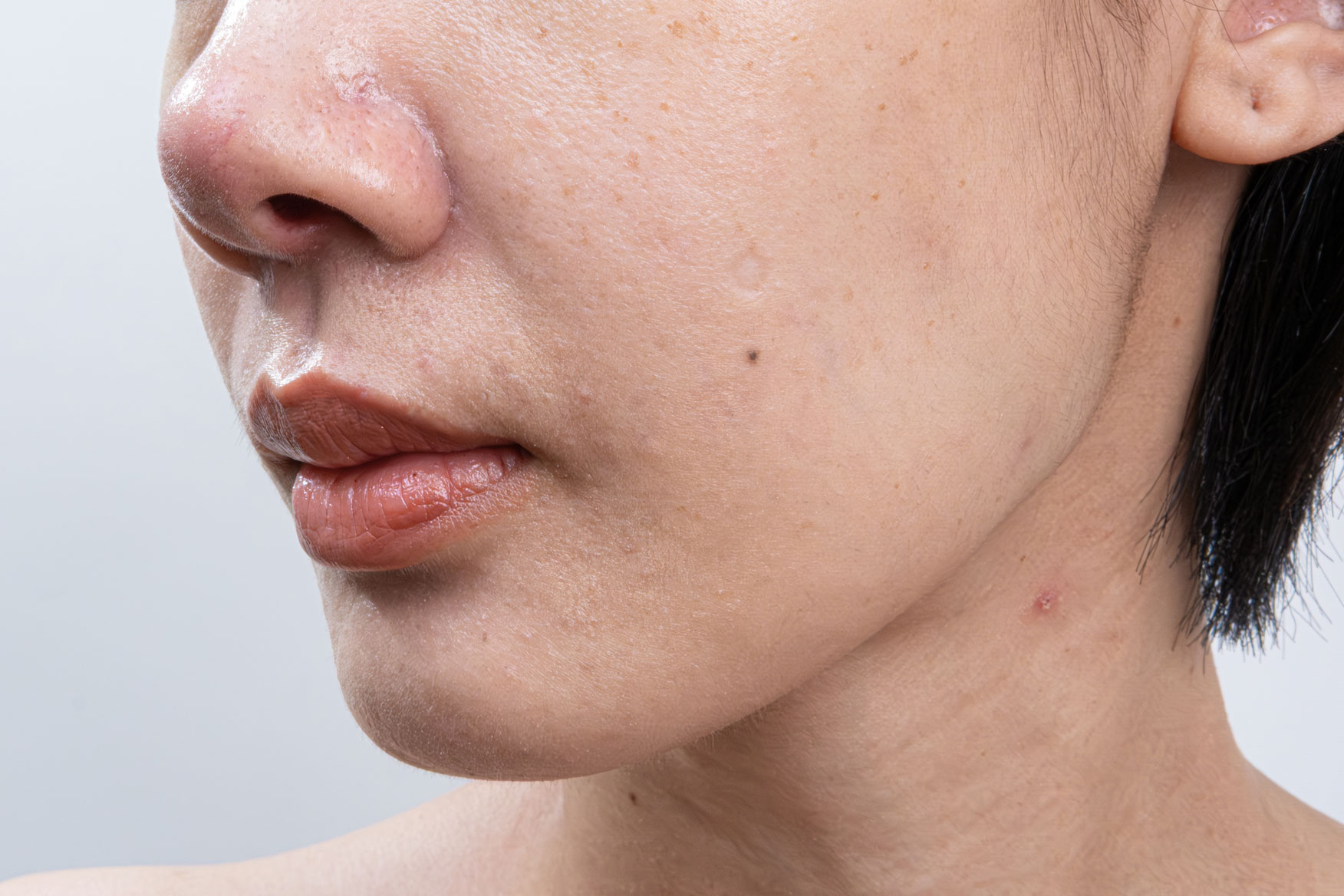 Women with textured skin and Uneven tone