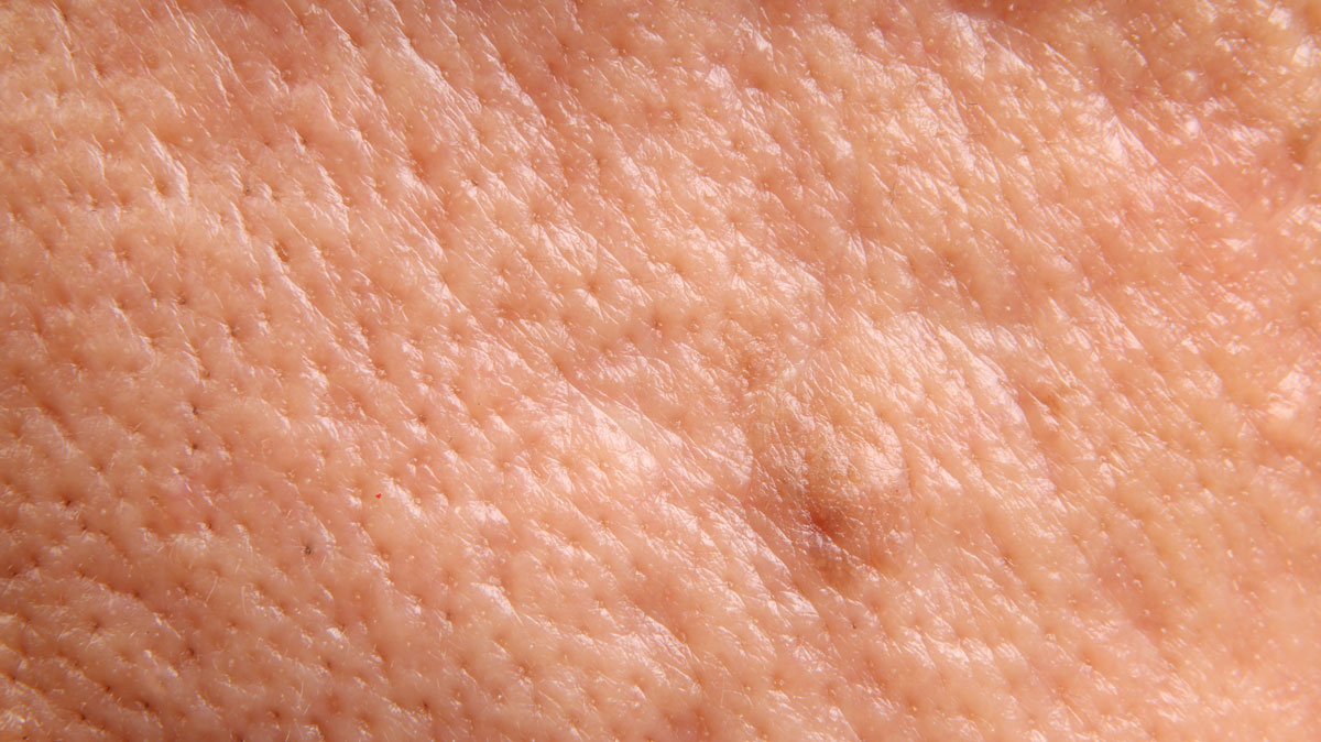Upclose image of pores