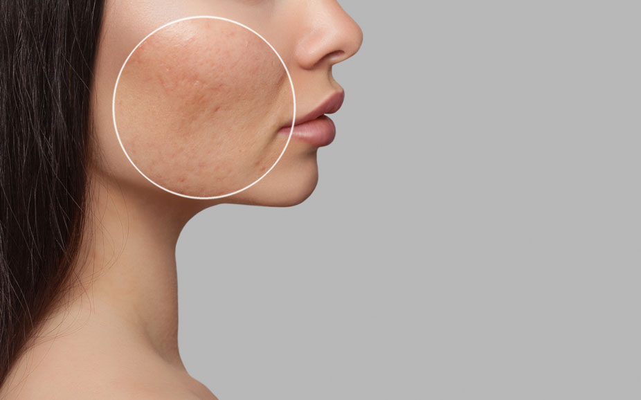 cheek with scars