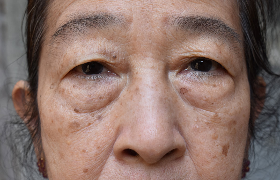 Ageing Woman