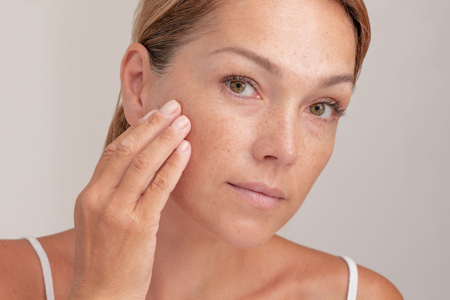 Women with freckles