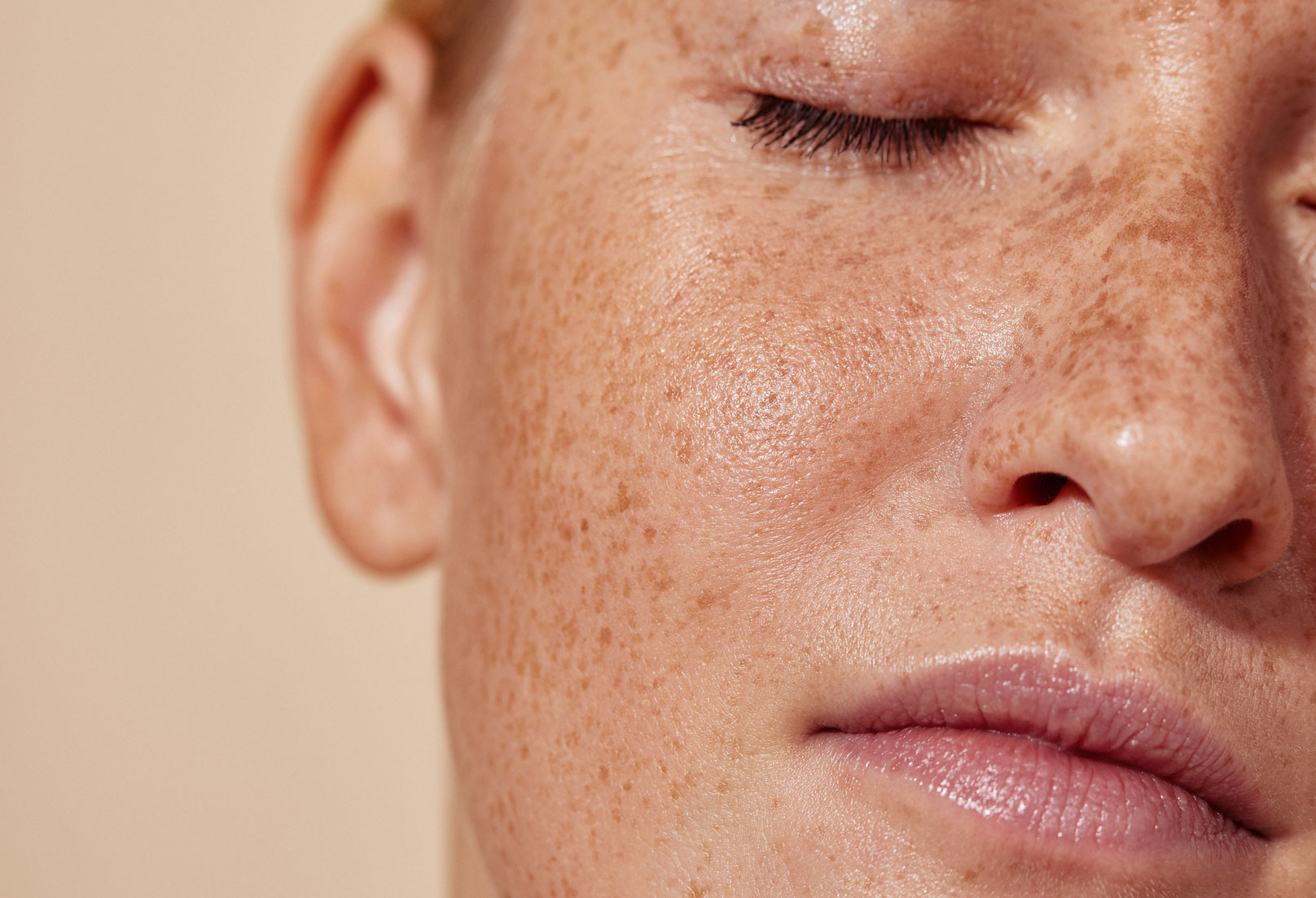 Woman with freckles