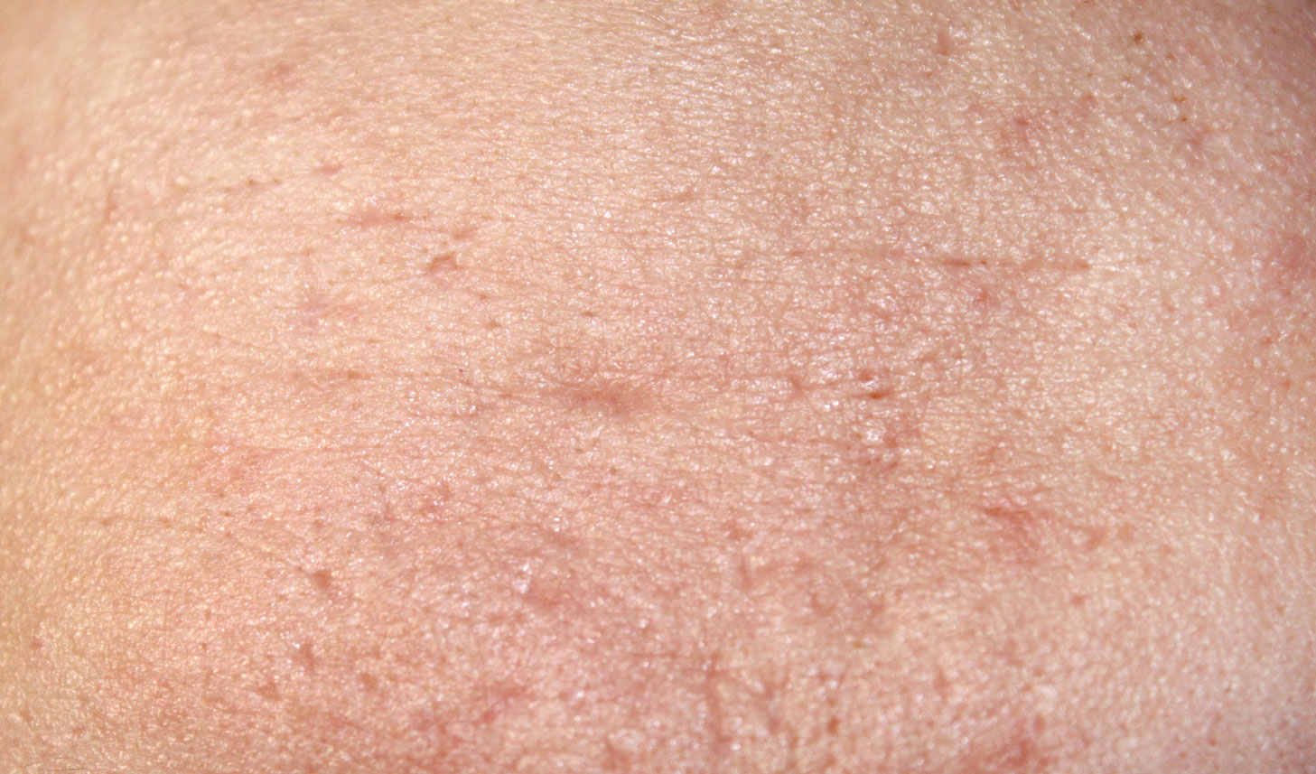 Skin Texture Close Up