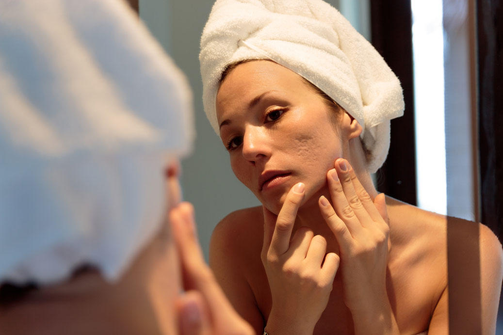 facial-scarring