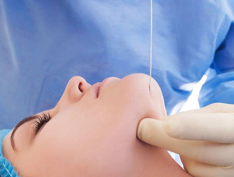 Laser-Lipo-Suction-at-Preface-Cosmetic-Newcastle Laser-Lipo-Suction-at-Preface-Cosmetic-Newcastle