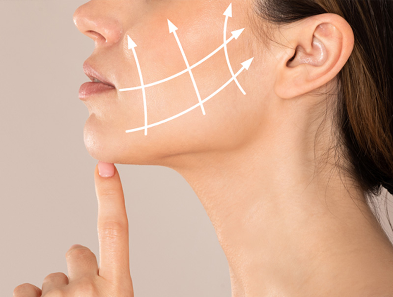 Cheek Lift Surgery Newcastle