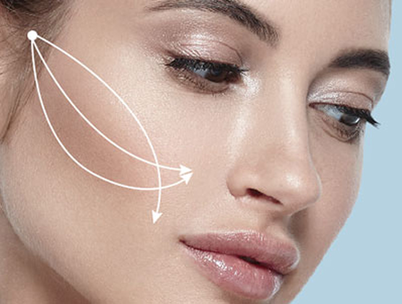 Thread Lifts in Newcastle and Maitland.